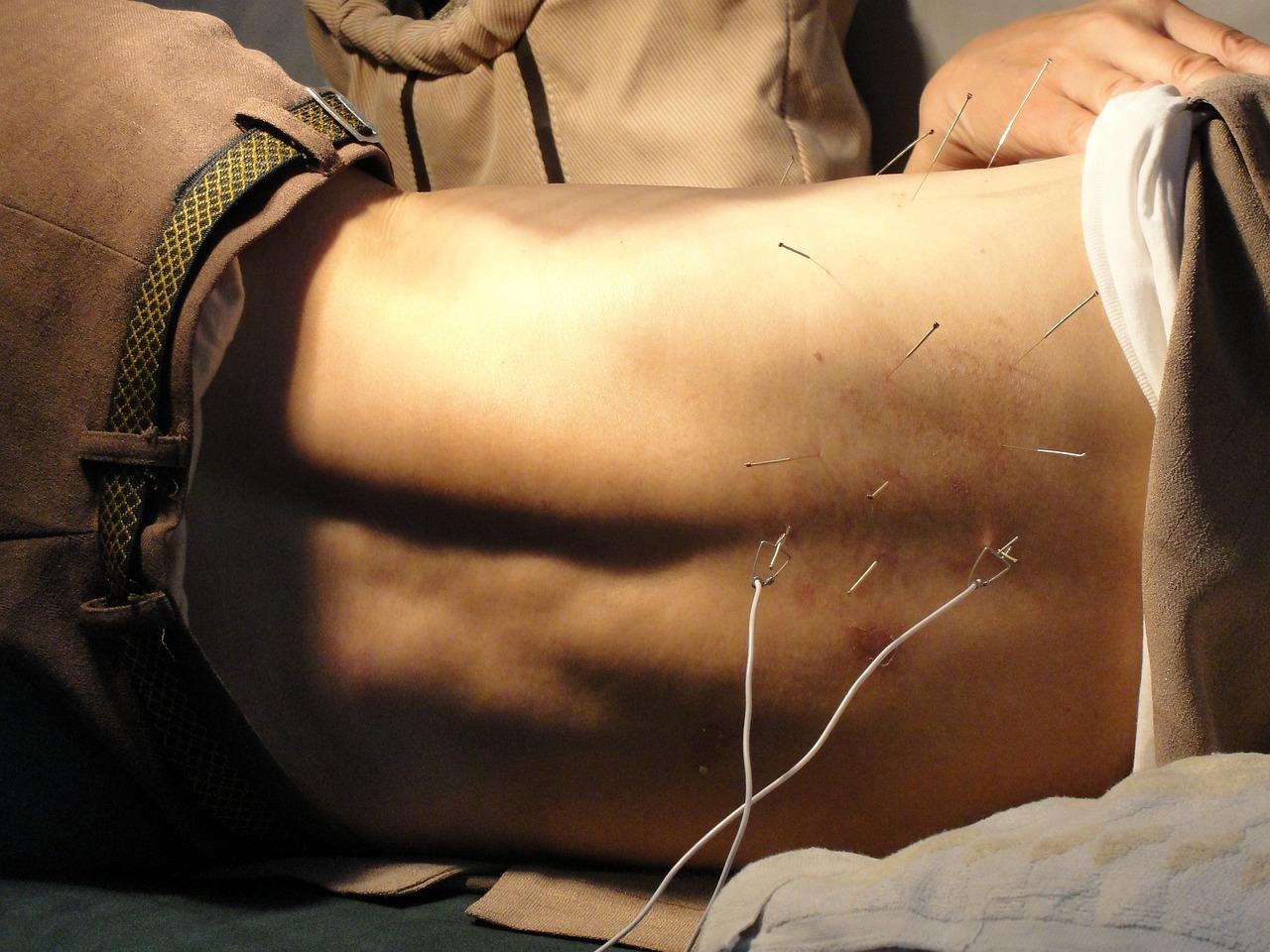 Acupuncturist in Almere